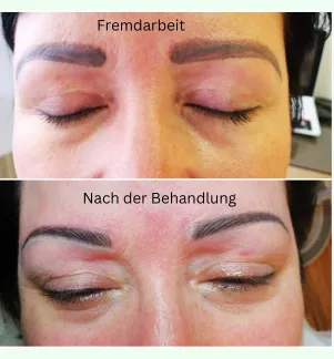 Permanent Make Up Augenbrauen entfernen 